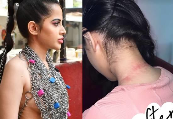 Urfi Javed gets badly injured after going topless & wearing heavy chain; See Pics