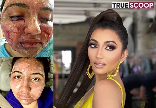 Who is Shree Saini? Once lost her face in brutal car accident, wins Miss World 2021 1st runner-up