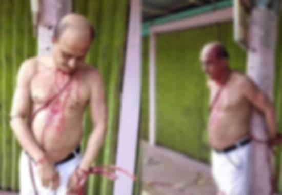 Bangladesh: Hindu leader tied & tortured for refusing Iftar party invitation; Pics viral