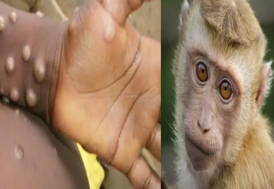 Monkeypox: Untreatable disease reported in Britain; Here are its causes, effects & symptoms