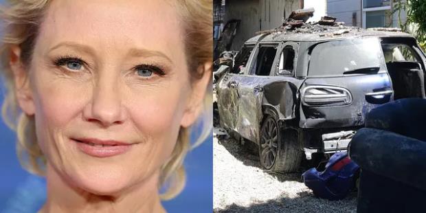 Actor-Director Anne Heche in Coma after the terrifying car crash in Los Angeles