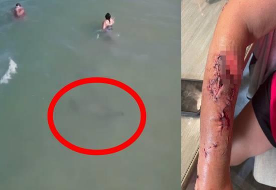 Myrtle-Beach Myrtle-Beach-Shark-Attack South-Carolina-Shark-Attack