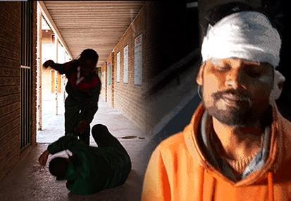 jalandhar-youth-beaten-up youth-beaten-up-for-stopping-drug-trafficking jalandhar-youth-ear-chopped-off